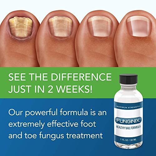 FUNGINIX Toenail Fungus Treatment Extra Strength Antifungal Liquid, 1 Bottle Q929